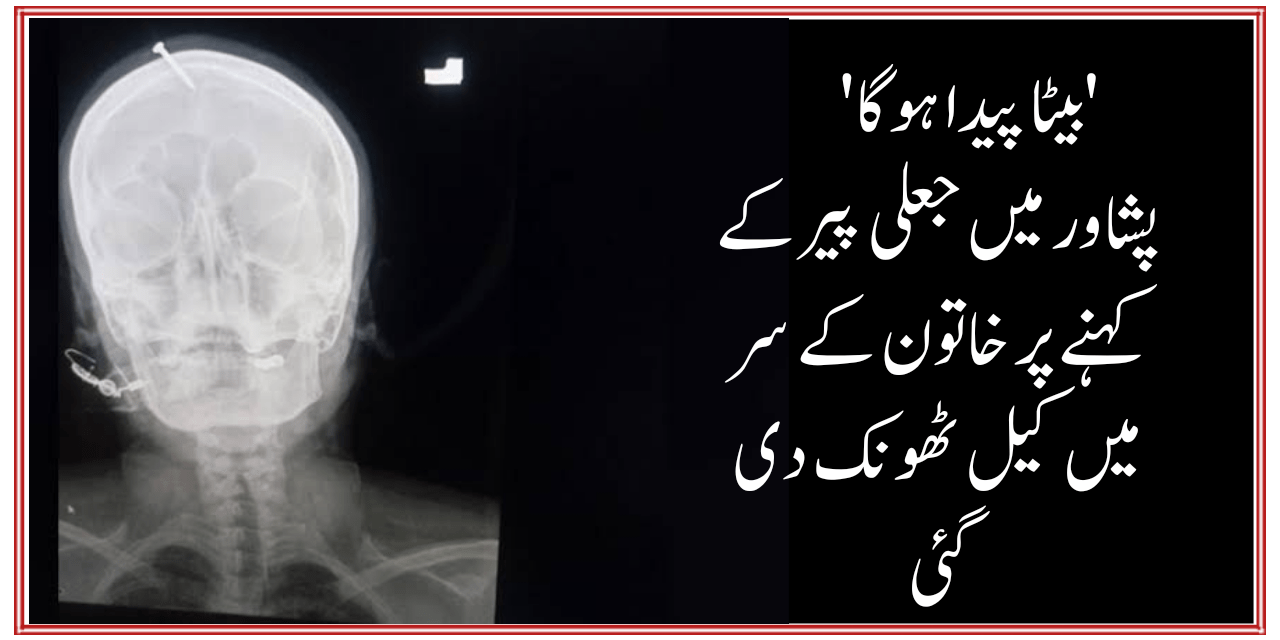 کیا جعلی عاملوں اور پیروں کا کوئی علاج نہیں…!